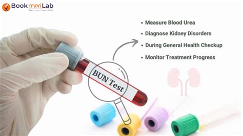 what does ue mean in a blood test|Urea Test.
